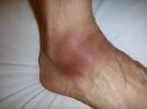 PIC_1ee942c6618188.jpg